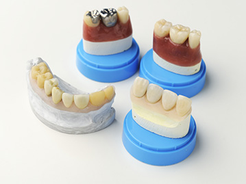 高品質の歯科技工士との連携